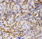 AMFR Antibody in Immunohistochemistry (Paraffin) (IHC (P))