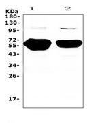 alpha Amylase 1 Antibody in Western Blot (WB)