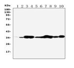 Annexin V Antibody in Western Blot (WB)