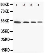 Annexin VII Antibody in Western Blot (WB)