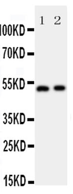 Annexin VII Antibody in Western Blot (WB)