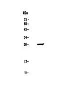 Serum Amyloid P Antibody in Western Blot (WB)