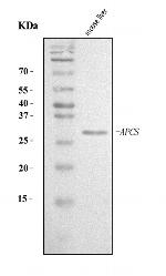 Serum Amyloid P Antibody in Western Blot (WB)