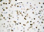 API5 Antibody in Immunohistochemistry (Paraffin) (IHC (P))