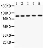 APLP1 Antibody in Western Blot (WB)