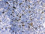 APOBEC3G Antibody in Immunohistochemistry (Paraffin) (IHC (P))