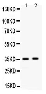 APOE Antibody in Western Blot (WB)