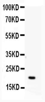 APRT Antibody in Western Blot (WB)