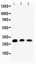 Aquaporin 1 Antibody in Western Blot (WB)