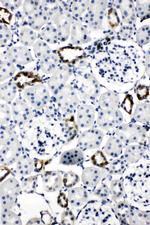 Aquaporin 2 Antibody in Immunohistochemistry (Paraffin) (IHC (P))