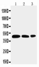 Aquaporin 2 Antibody in Western Blot (WB)