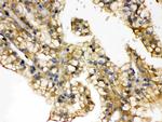 Aquaporin 2 Antibody in Immunohistochemistry (Paraffin) (IHC (P))