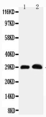 Aquaporin 5 Antibody in Western Blot (WB)