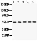 ARSA Antibody in Western Blot (WB)