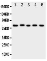 ASIC3 Antibody in Western Blot (WB)