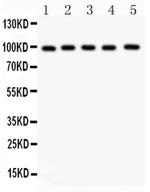 ASPH Antibody in Western Blot (WB)