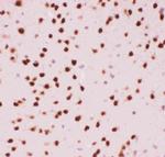 ATF2 Antibody in Immunohistochemistry (Paraffin) (IHC (P))