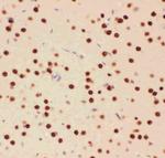 ATF2 Antibody in Immunohistochemistry (Paraffin) (IHC (P))