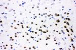 ATF2 Antibody in Immunohistochemistry (Frozen) (IHC (F))