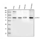 ATF2 Antibody in Western Blot (WB)