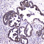 ATF4 Antibody in Immunohistochemistry (Paraffin) (IHC (P))