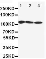 SERCA1 ATPase Antibody in Western Blot (WB)