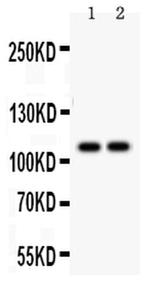 SERCA1 ATPase Antibody in Western Blot (WB)