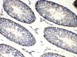 BAG1 Antibody in Immunohistochemistry (Paraffin) (IHC (P))