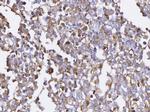 BCAT1 Antibody in Immunohistochemistry (Paraffin) (IHC (P))