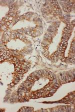 Bcl-W Antibody in Immunohistochemistry (Paraffin) (IHC (P))