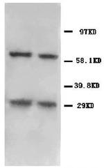 BNIP3 Antibody in Western Blot (WB)