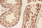 BRCA1 Antibody in Immunohistochemistry (Paraffin) (IHC (P))