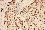 BRCA1 Antibody in Immunohistochemistry (Paraffin) (IHC (P))