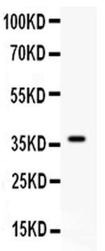 Complement C5a Antibody in Western Blot (WB)