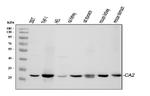 Carbonic Anhydrase II Antibody in Western Blot (WB)