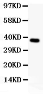 CADM1 Antibody in Western Blot (WB)