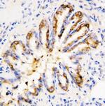 Calpain 1 Antibody in Immunohistochemistry (Paraffin) (IHC (P))