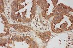 Calpain 1 Antibody in Immunohistochemistry (Paraffin) (IHC (P))