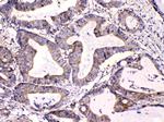 Calpastatin Antibody in Immunohistochemistry (Paraffin) (IHC (P))