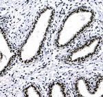 HP1 gamma Antibody in Immunohistochemistry (Paraffin) (IHC (P))