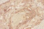 Eotaxin 3 Antibody in Immunohistochemistry (Paraffin) (IHC (P))