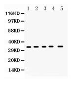 CCS Antibody in Western Blot (WB)