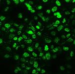 CCT3 Antibody in Immunocytochemistry (ICC/IF)