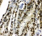 CCT3 Antibody in Immunohistochemistry (Paraffin) (IHC (P))