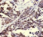 CCT3 Antibody in Immunohistochemistry (Paraffin) (IHC (P))