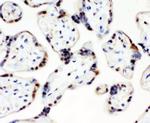 CCT3 Antibody in Immunohistochemistry (Paraffin) (IHC (P))