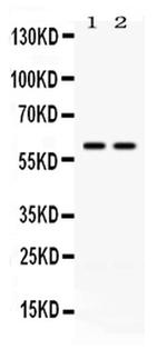 CCT3 Antibody in Western Blot (WB)