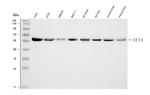 TCP-1 delta Antibody in Western Blot (WB)