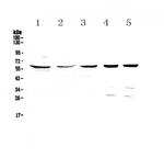 TCP1 eta Antibody in Western Blot (WB)