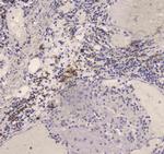 DC-SIGN (CD209) Antibody in Immunohistochemistry (Paraffin) (IHC (P))